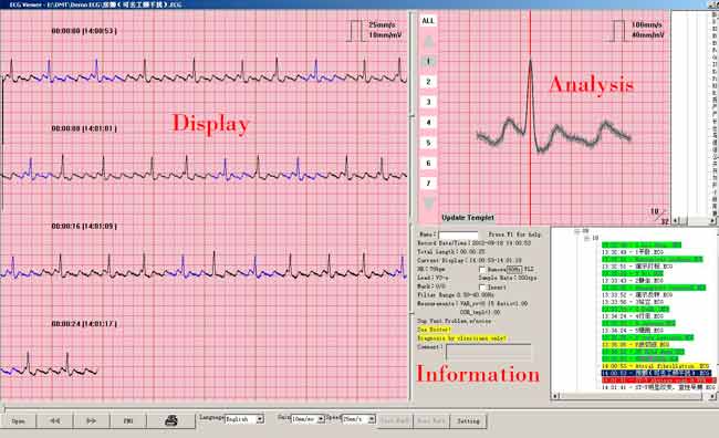 analysis screen