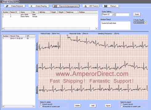 md100a1 ecg report