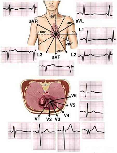 12 lead ecg