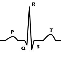 ECG waveform