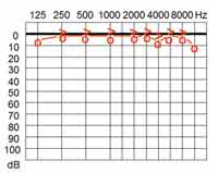 audiogram - normal hearing