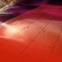 home ecg monitor
