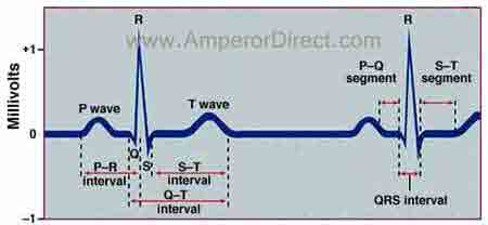 EKG components