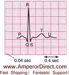 ECG graph