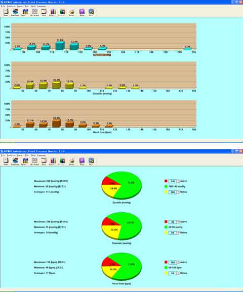 ABPM-50 ambulatory blood pressure monitor report