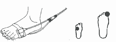 wrap oximeter probe positions 1