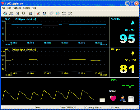 CMS60CW sample report 1