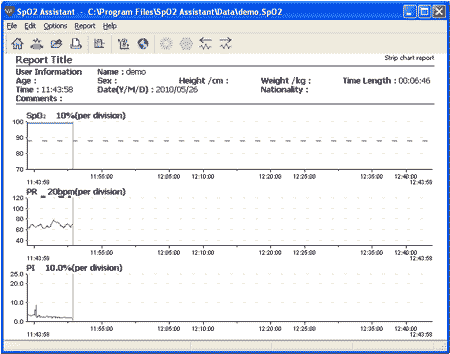 CMS60CW sample report 2