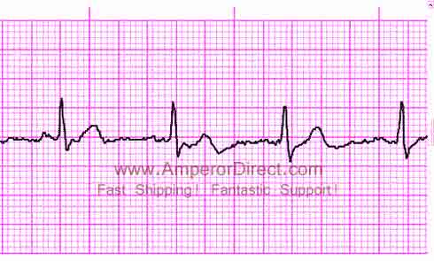 Electrocardiógrafo ECG Portátil CHOICEMMED MD100E