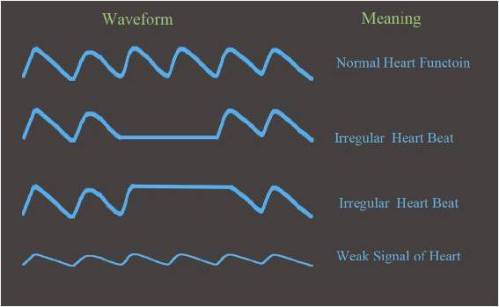 Finger Pulse Oximeter Reading Chart