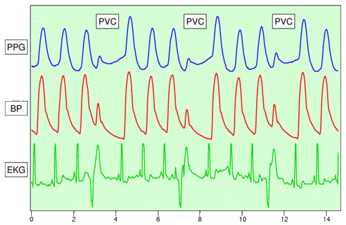 Pulse Oximeter Chart